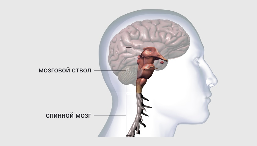 Аномалия Арнольда — Киари - что это такое