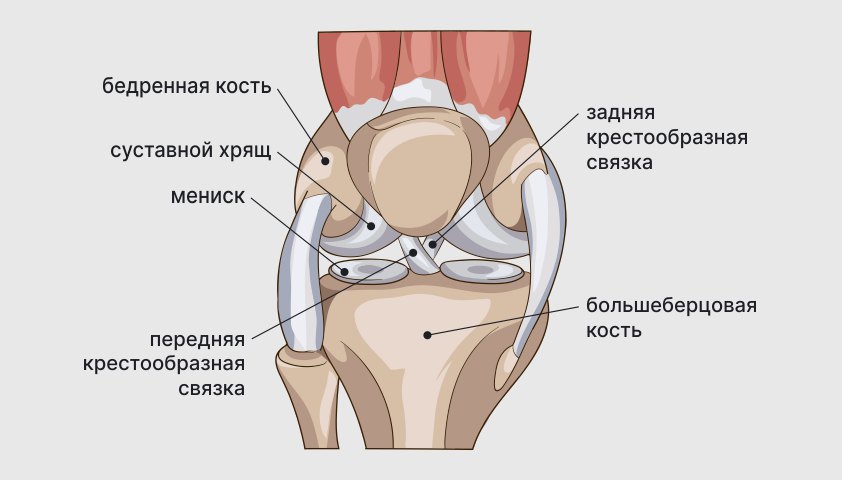 Артроз коленного сустава (гонартроз) — симптомы, степени, диагностика, лечение