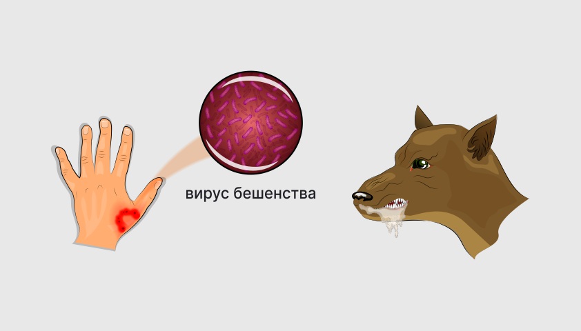 Микоз стоп (грибок на ногах) - как выглядит, причины, симптомы и лечение