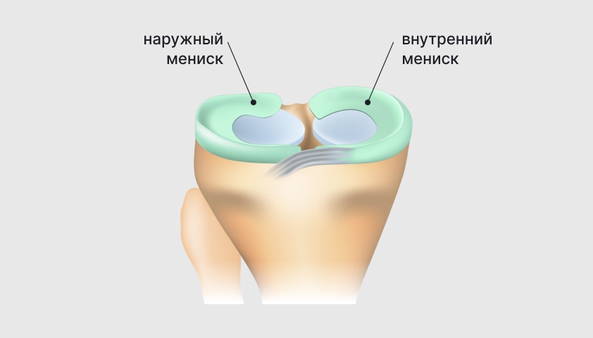 Дисменорея ‒ что это, причины и лечение