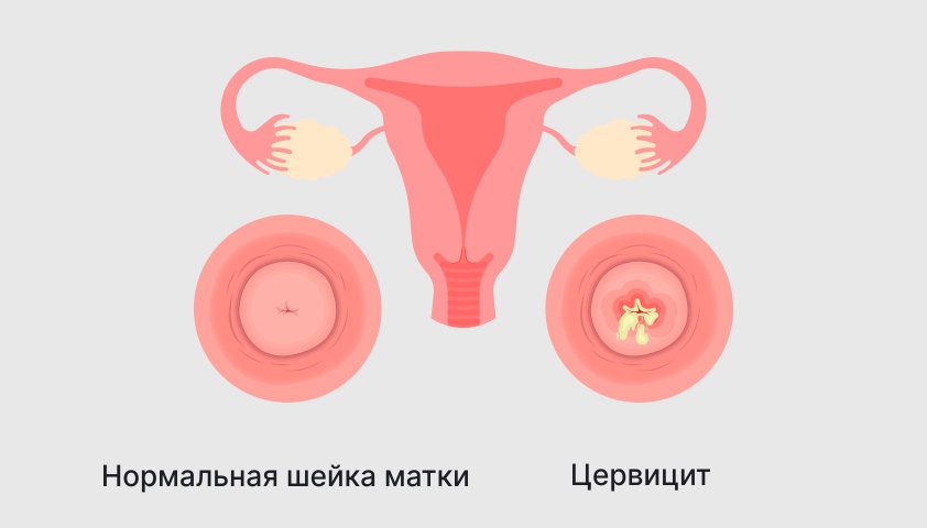 Шейка матки — как выглядит у женщины, где находится, нормы длины