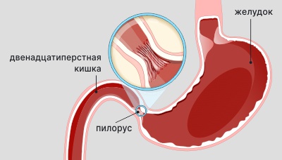 Пилорус