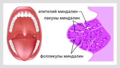 Небные-миндалины2