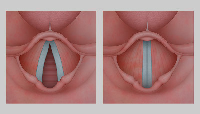 Голосовые связки
