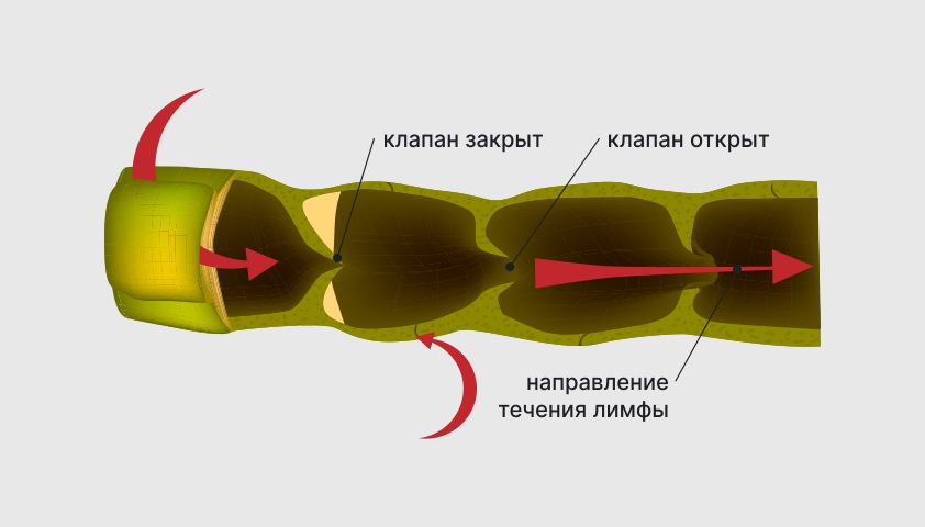 Недостаточность митрального клапана - что это, какие степени, причины